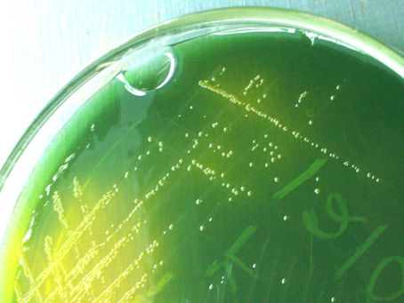 Destroy all Vibrio: How PNSB Safeguard Against Disease 
