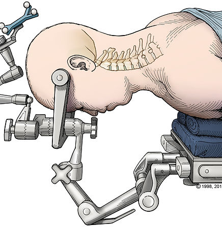 surgery