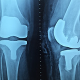 doctor-g5bc2f390b_1920.jpg