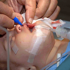 cirugia reconstructiva.jpg