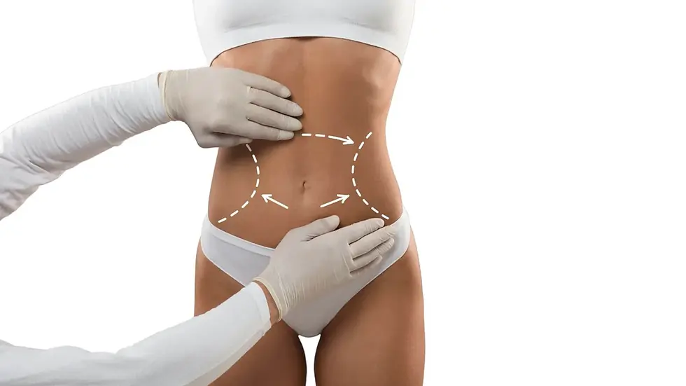 Dr-Daniela-Correa-Cirujana-prepararse-para-una-liposuccion-1