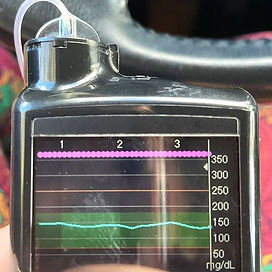 Sarah says, "These are my blood sugar levels!!! As a Type 1, insulin dependent, diabetic for the last 18 years, these are the most STABLE my sugars have been and with the LEAST amount of insulin!"