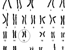 Enfermedades genéticas de judíos