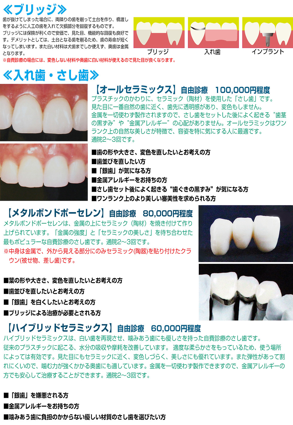 入れ歯説明