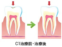 診療案内  札幌市中央区のインプラントはミルキーデンタルクリニックへ