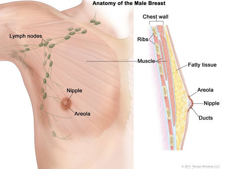 Breast Cancer in Men