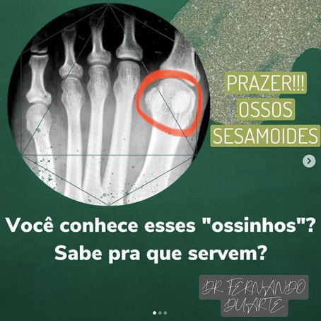 Ossos Sesamoides (sesamoidite)