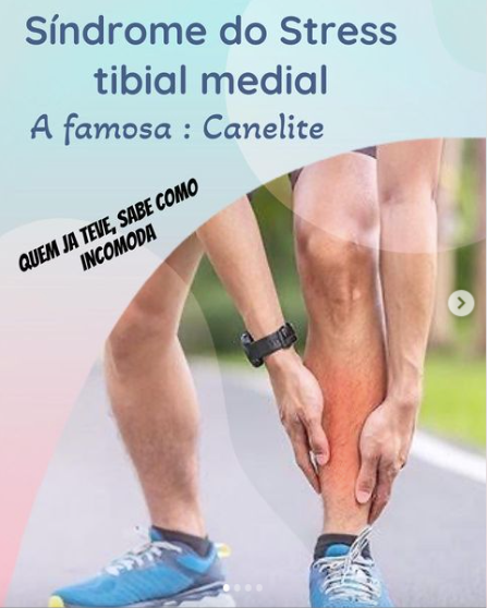 CANELITE (SD.STRESS TIBIAL MEDIAL)