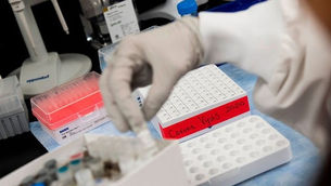 Tasas de mortalidad por coronavirus estables o en descenso, incluso en estados con casos en aumento.