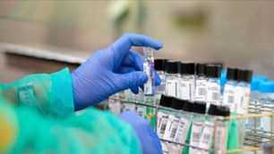 Virólogo italiano afirma que carga viral del coronavirus es 100 veces menor que en marzo.