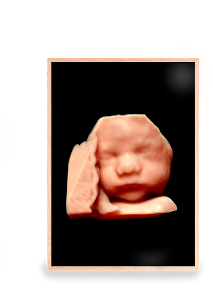 Detaljeret og smukt 3D scanningsbillede Forfra taget af Stork Scan