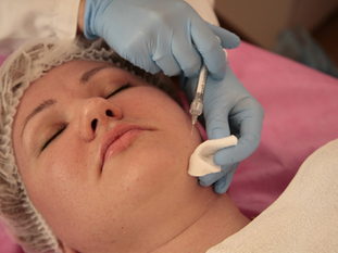 Top 10 Toronto Skin Care Clinics for Healthy, Glowing Skin