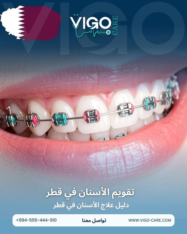 تقويم الأسنان في قطر