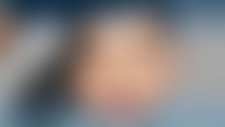 Ботокс в Азербайджане