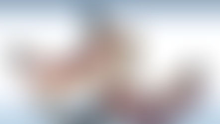 تركيبات الأسنان في الكويت - دليل علاج الأسنان في الكويت