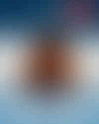 زراعة الشعر في تركيا