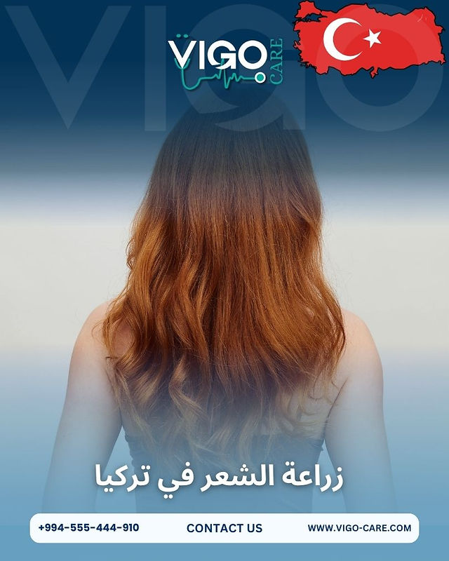 زراعة الشعر في تركيا