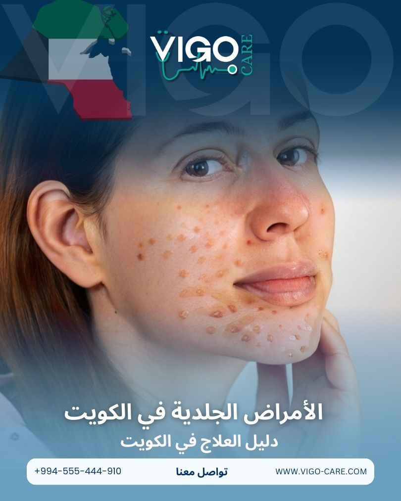 الأمراض الجلدية في الكويت - دليل العلاج في الكويت