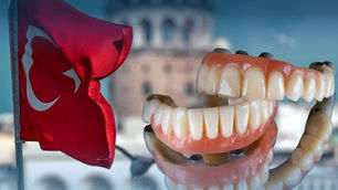 علاج الأسنان في تركيا