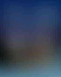 زراعة الشعر في تركيا