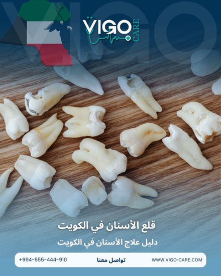 تنظيف الأسنان في الكويت