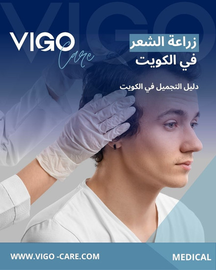 زراعة الشعر في الكويت