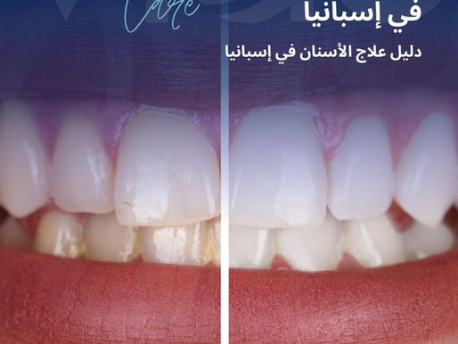 تُعد ابتسامة هوليود في إسبانيا من أكثر الإجراءات التجميلية طلبًا في مجال طب الأسنان، لما توفره من تحسين شامل لشكل الأسنان والابتسامة. يختار المرضى إسبانيا لما تتميز به من دقة في التصميم ونتائج طبيعية تعكس جمال الابتسامة دون مبالغة. ابتسامة هوليود في إسبانيا - دليل ابتسامة هوليود في إسبانيا