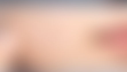 Acne Treatment in Azerbaijan Types of Acne Treatment in Azerbaijan Advantages of Acne Treatment in Azerbaijan Benefits of Acne Treatment in Azerbaijan The Role of Vigo Care in Acne Treatment in Azerbaijan Medical Tourism in Azerbaijan Treatment in Azerbaijan Cosmetic Surgery in Azerbaijan