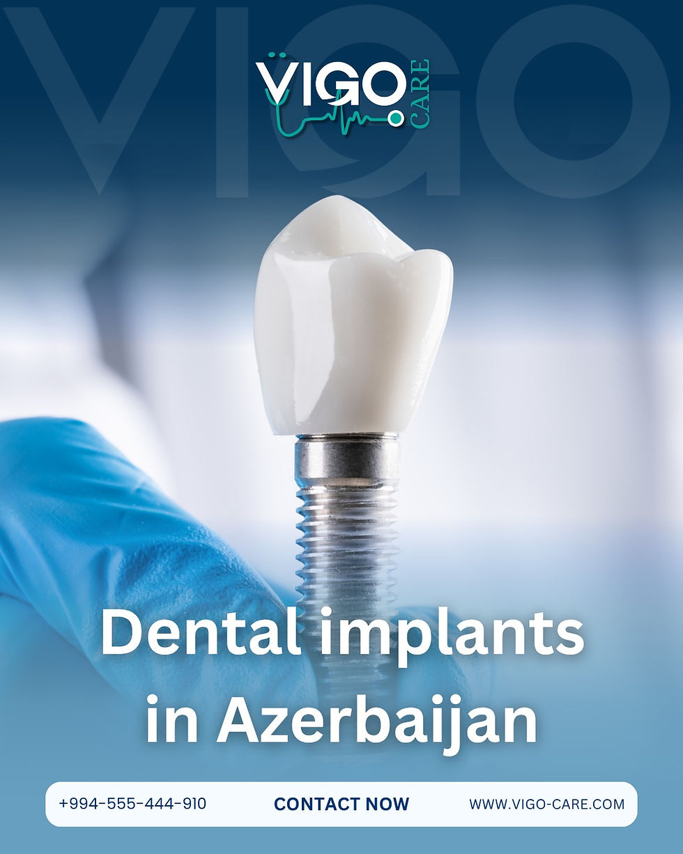 Let us learn through the dental implant guide in Azerbaijan about the most important points that concern patients regarding dental implants in Azerbaijan.  Dental implants in Azerbaijan are your first choice to start a new stage of beauty.  Costs of dental implants in Azerbaijan - Why dental implants in Azerbaijan - Advantages of dental implants in Azerbaijan - How dental implants are performed in Azerbaijan - Questions about dental implants in Azerbaijan
