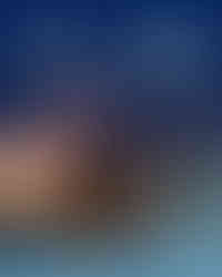 عمليات التجميل في ايران