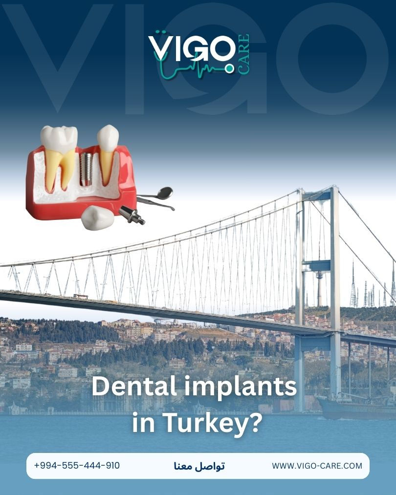Dental Implants in Turkey