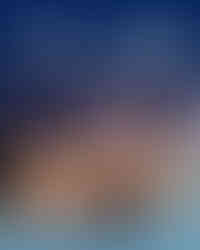 تجميل الانف في لبنان