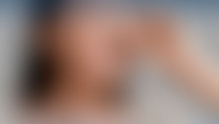 Why Rhinoplasty in Azerbaijan?