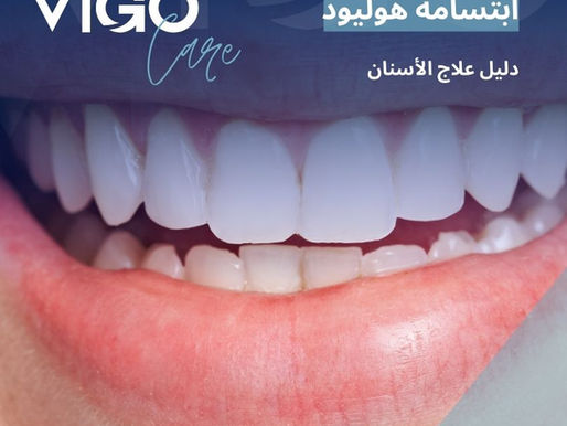 تُعد ابتسامة هوليود من أكثر علاجات تجميل الأسنان طلبًا في العالم، لما تمنحه من مظهر جمالي متناسق وأسنان ناصعة البياض ذات شكل منتظم. ولا تقتصر ابتسامة هوليود على الجانب التجميلي فقط، بل تشمل تحسين شكل الأسنان، إغلاق الفراغات، وتصحيح العيوب الظاهرة التي تؤثر على الابتسامة. تعتمد ابتسامة هوليود على تقنيات حديثة في طب الأسنان التجميلي، مع تخطيط دقيق يراعي ملامح الوجه، شكل الشفاه، ولون البشرة، لضمان نتيجة طبيعية ومتناسقة. ابتسامة هوليود - دليل ابتسامة هوليود