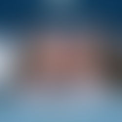 Прозрачные брекеты в Азербайджане Прозрачные брекеты в Азербайджане — идеальная улыбка без металлических брекетов Виды прозрачных брекетов в Азербайджане Преимущества прозрачных брекетов в Азербайджане Преимущества прозрачных брекетов в Азербайджане Отличия прозрачных брекетов в Азербайджане от традиционных Прозрачные брекеты в Азербайджане с Vigo Care