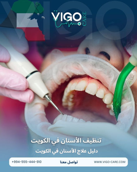 تنظيف الأسنان في الكويت
