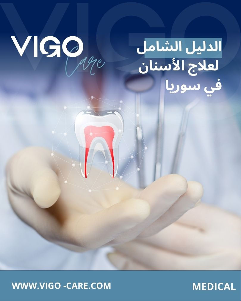 الدليل الشامل لعلاج الأسنان في سوريا - علاج الأسنان في سوريا