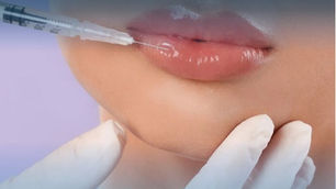 الفيلر و البوتوكس في الكويت - دليل التجميل في الكويت