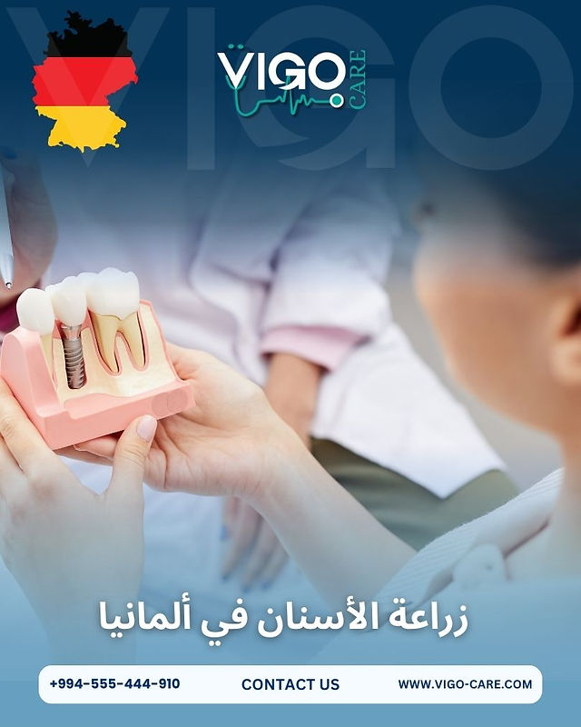 زراعة الاسنان في المانيا