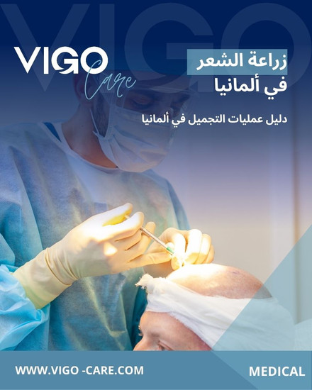 زراعة الشعر في المانيا