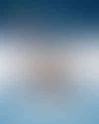 طب العيون في الكويت