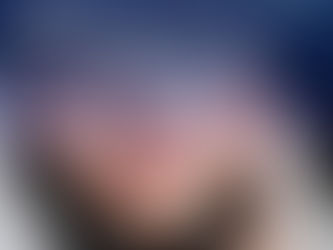 Rhinoplasty in Qatar is a highly requested cosmetic and functional procedure designed to enhance the shape of the nose and improve breathing function when needed. With modern surgical techniques and experienced plastic surgeons, Qatar offers safe and precise nose reshaping procedures tailored to each patient’s facial features and aesthetic goals. Rhinoplasty in Qatar - Rhinoplasty in Qatar Guide