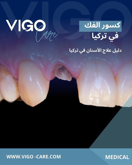 كسور الفك في تركيا