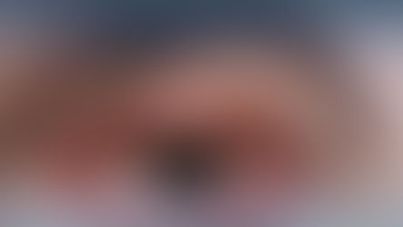 تُعد إيران من الدول الرائدة في علاج العيون، حيث توفر مراكز متخصصة لعلاج مختلف الحالات مثل ضعف البصر، الجلوكوما، اعتلال الشبكية السكري، إعتام عدسة العين، وتصحيح البصر بالليزر. تعتمد المراكز على أحدث التقنيات الطبية والأجهزة الرقمية المتطورة لتقديم رعاية دقيقة وفعّالة للمرضى المحليين والدوليين.