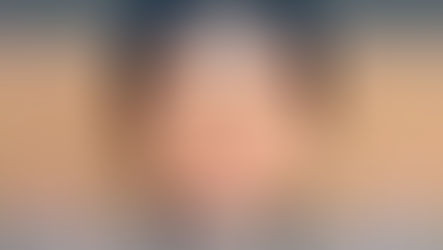 تُعد زراعة الشعر في إيران من أكثر الإجراءات طلبًا ضمن السياحة العلاجية، حيث يجمع المرضى بين الخبرة الطبية العالية والتكلفة المناسبة. تعتمد العيادات في إيران على أحدث تقنيات الزراعة مثل FUE وFUT، مما يمنح نتائج طبيعية ودائمة للشعر دون ترك ندوب واضحة.