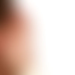 Self Reported Outcomes: The Best Results Come From Listening