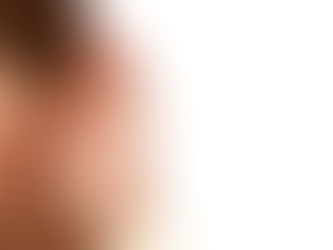 Self Reported Outcomes: The Best Results Come From Listening