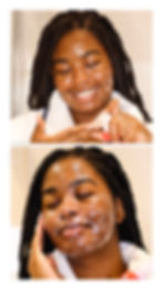 Let’s dive into what is contact dermatitis, how to prevent and treat it so you easily try or add new skincare products into your skincare routine!