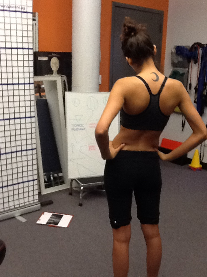 Before Posture Correction
