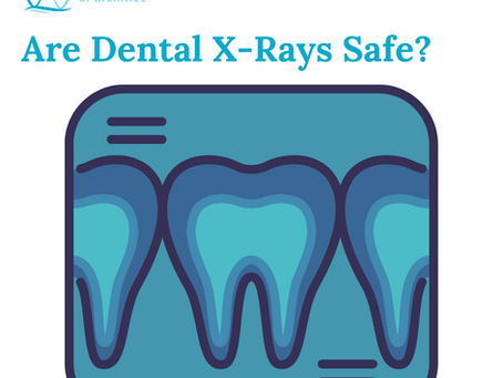Are Dental X-Rays Safe? A Response from Family Dentistry of Braintree